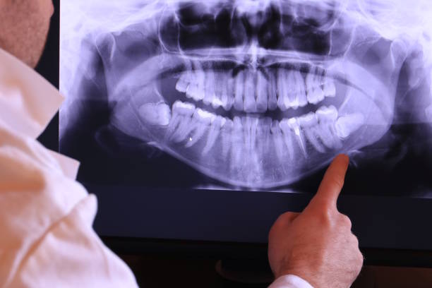 Best Urgent Tooth Repair  in Abingdon, MD